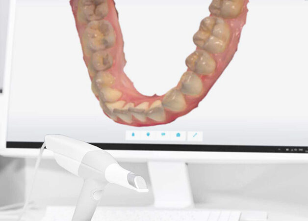 Intraoralscanner